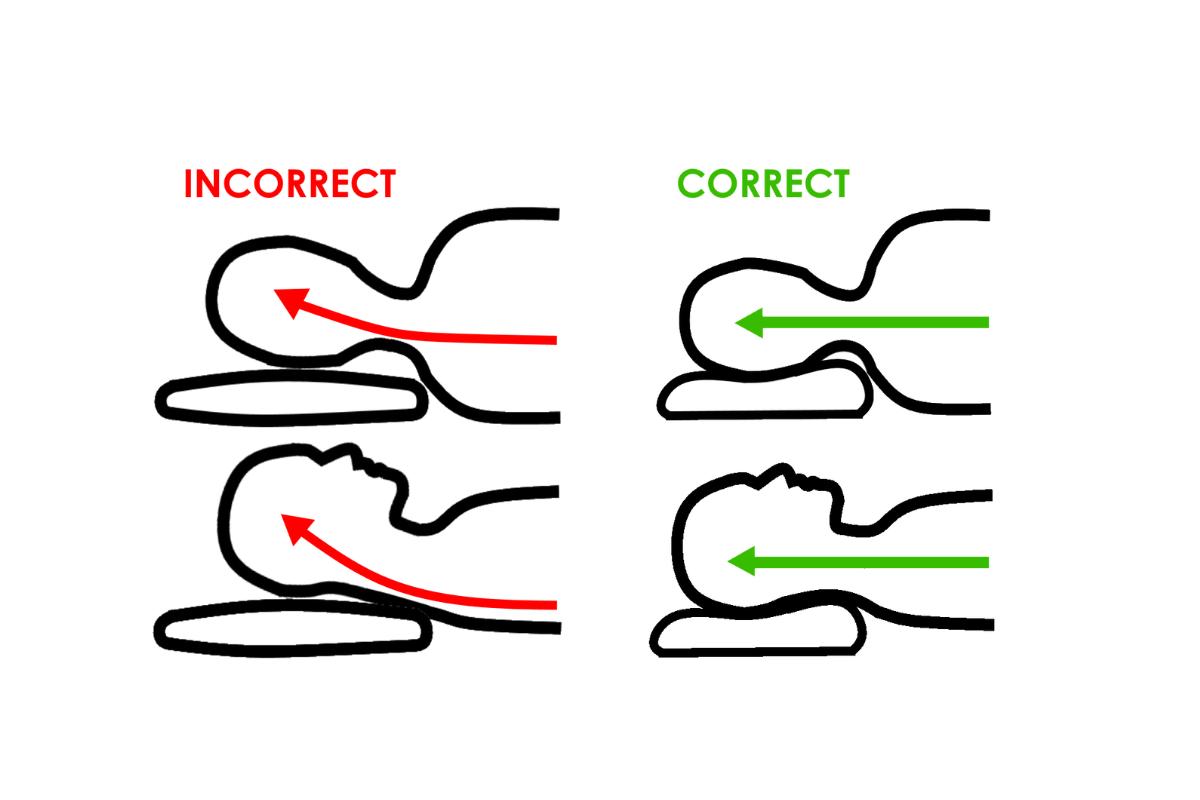 Diagram showing correct and incorrect neck alignment during sleep